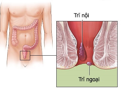 Jual Ambejos Salep Salwa Herbal Denature Di Karo
