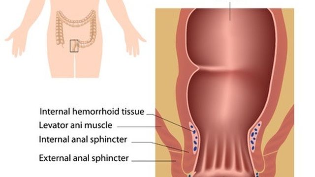 Jual Ambejos Salep Salwa Herbal Denature Di Tapanuli Tengah