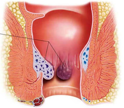 Jual Ambejos Salep Salwa Herbal Denature Di Sinjai